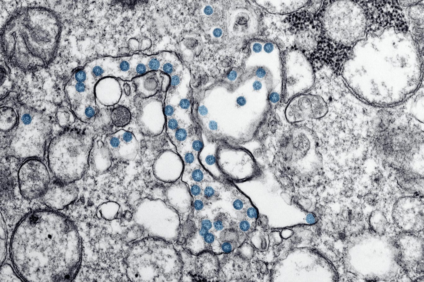 Pioneering Research at KAIST Unveils Innovative Approach to Cancer Treatment