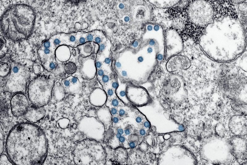 Pioneering Research at KAIST Unveils Innovative Approach to Cancer Treatment