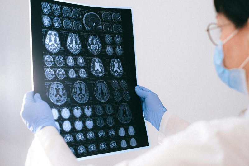 Cambridge Study Reveals Gender Differences in Brain Structure from Birth