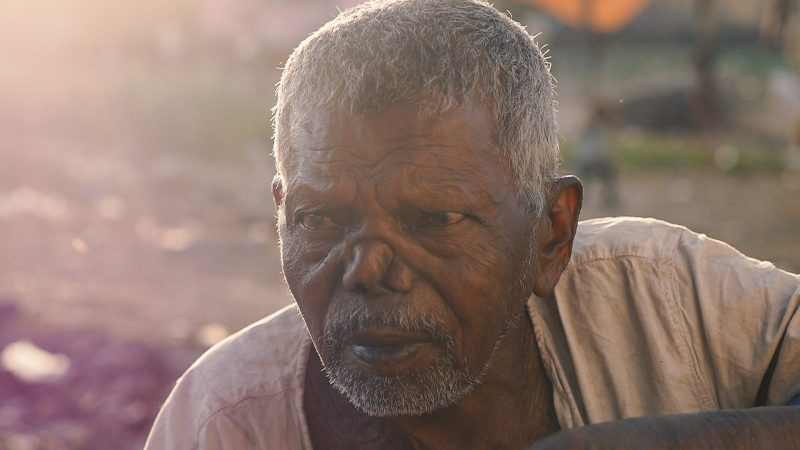 Ancient American Origins of Leprosy Pathogen Redraw Global Disease History