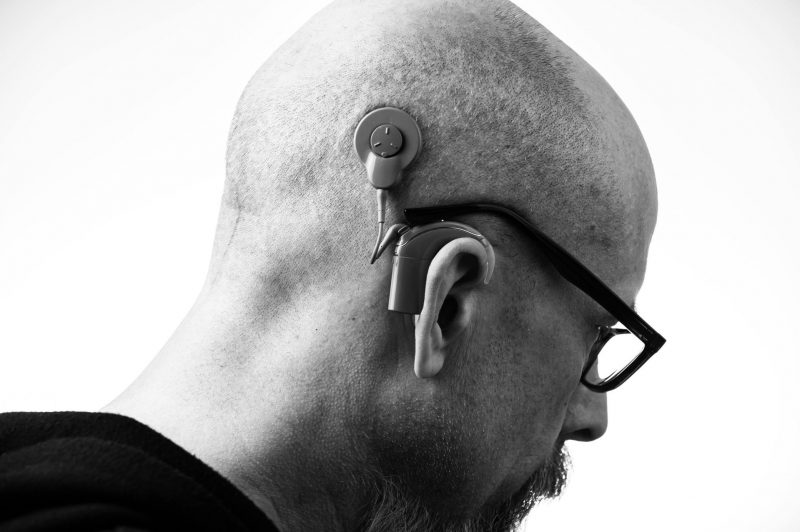 Hearing Aids and Cochlear Implants Boost Social Engagement and May Promote Longevity